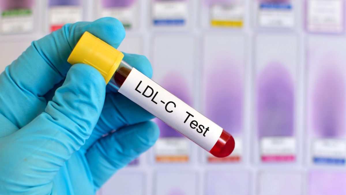 blue-gloved hand holding a vial with the label reading "LDL-C Test"